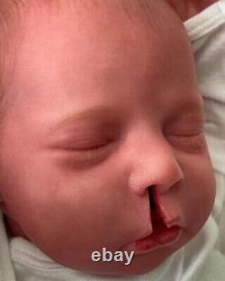 Realborn dustin cleft lip cleft palate reborn baby doll